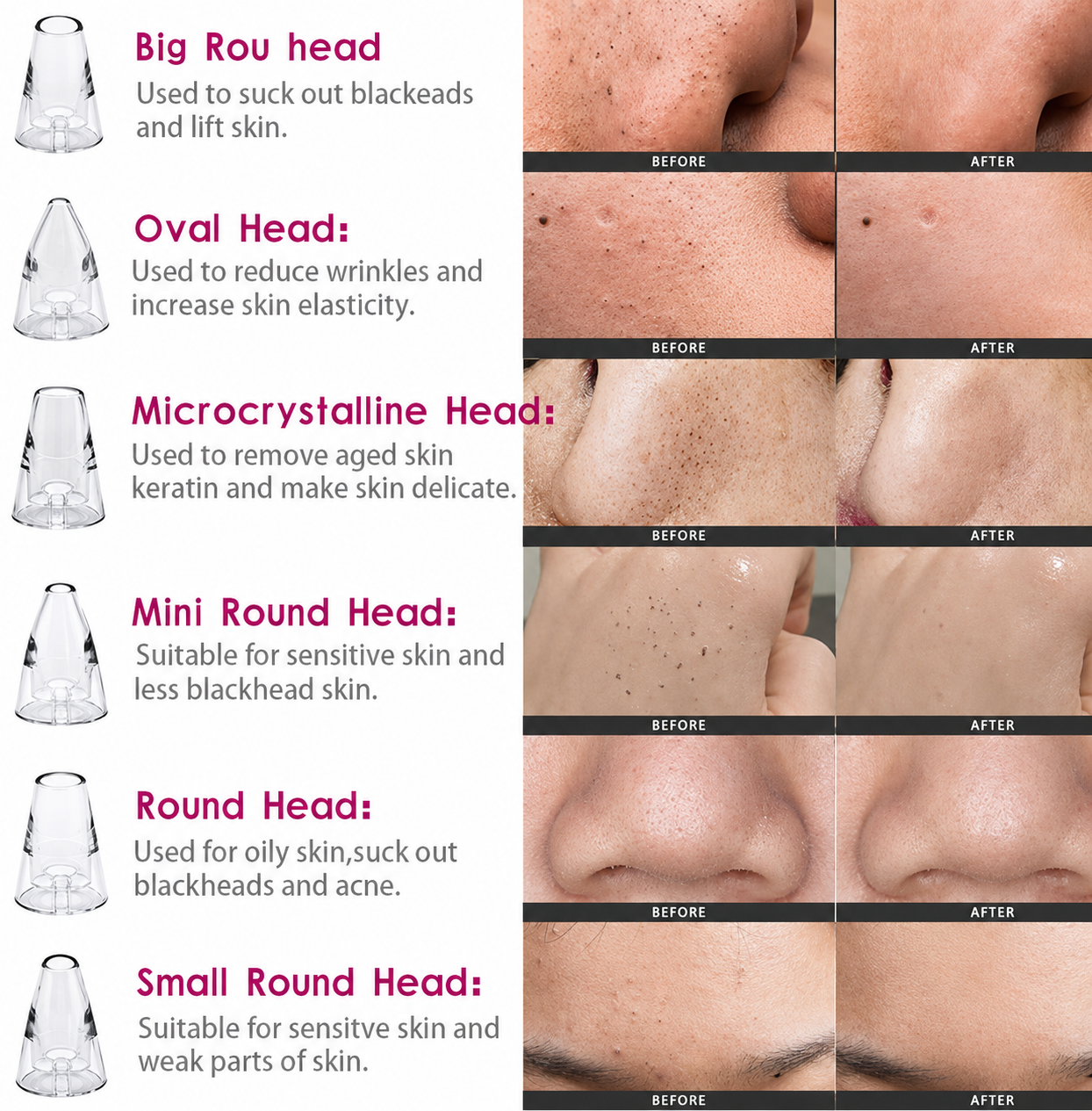Premium Multi-Functional Black & Whitehead Remover For Pore & Pimples Cleaner Machine Men & Women